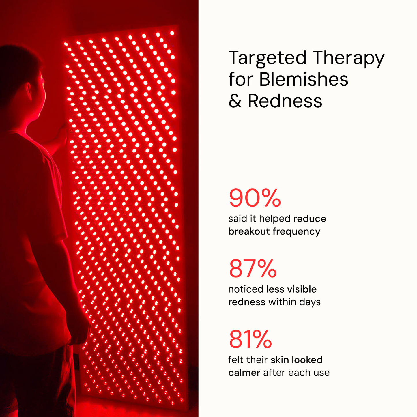 Red Light Therapy RTX 300MAX